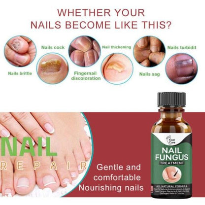 Fast Nail Fungal Treatments Nail Repair Essences Serum Care Treatments Foot Nail Fungus Removal Gel Paronychia Onychomycosis