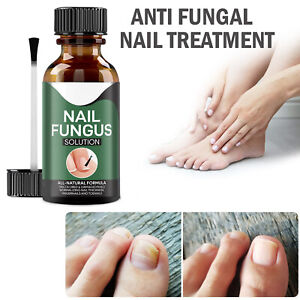 Fast Nail Fungal Treatments Nail Repair Essences Serum Care Treatments Foot Nail Fungus Removal Gel Paronychia Onychomycosis